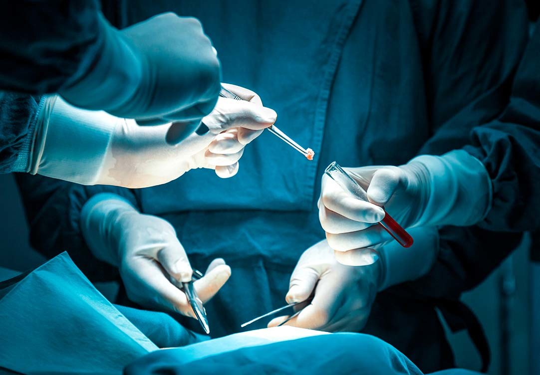 Cirurgia-oncologica-segura-com-o-tratamento-multidisciplinar