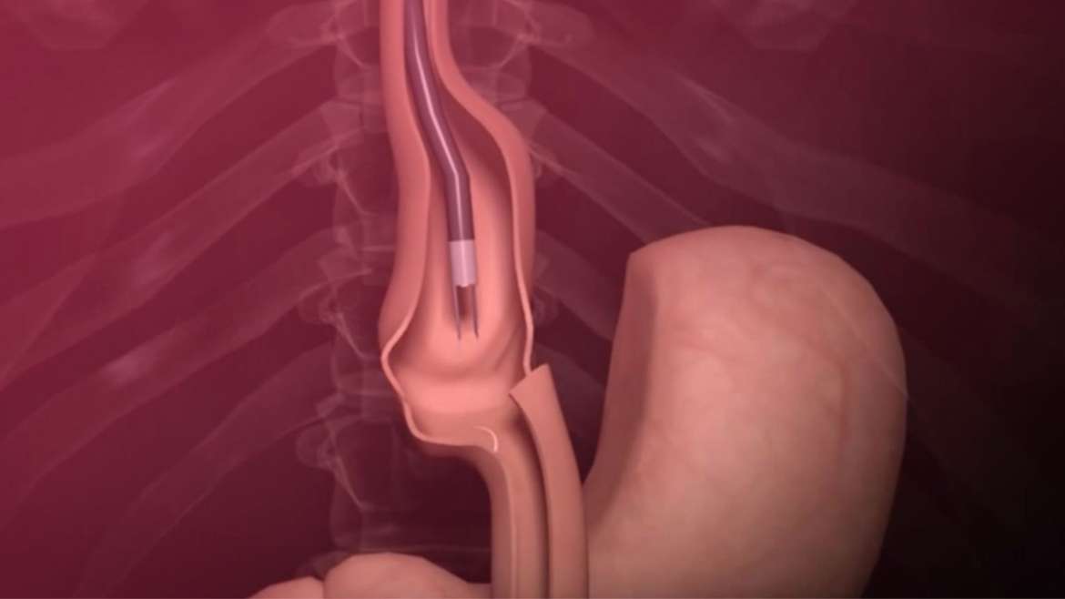 Gastro-Center-13-1170x658