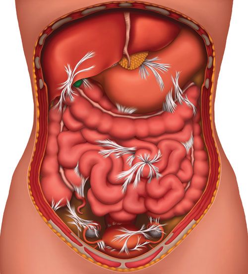 endo-no-intestino