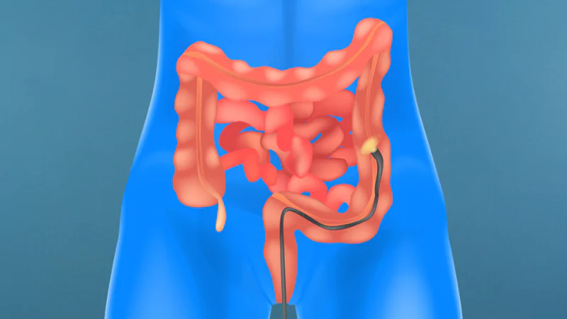 gastroendo-endoscopia-colonoscopia-rj-gastroenterologia-exames-retossigmoidoscopia-flexivel